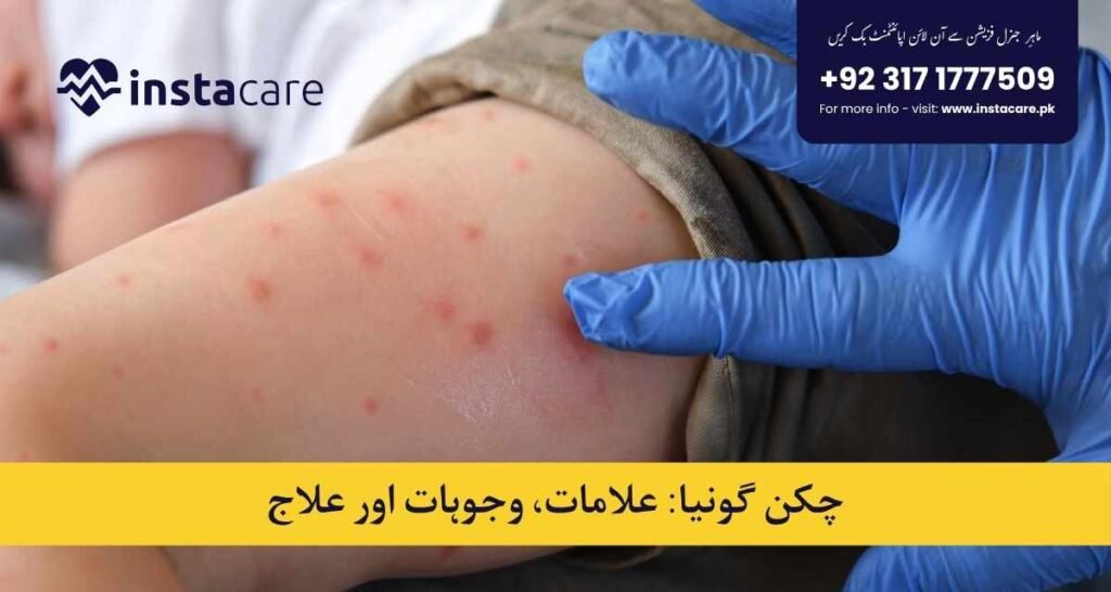 Chikungunya