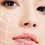 definesgfacelift