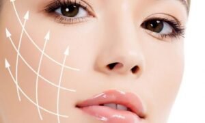 definesgfacelift