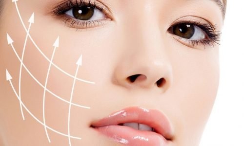 definesgfacelift