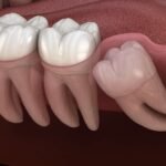 figsdentalwishdhomteeth