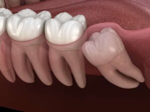 figsdentalwishdhomteeth