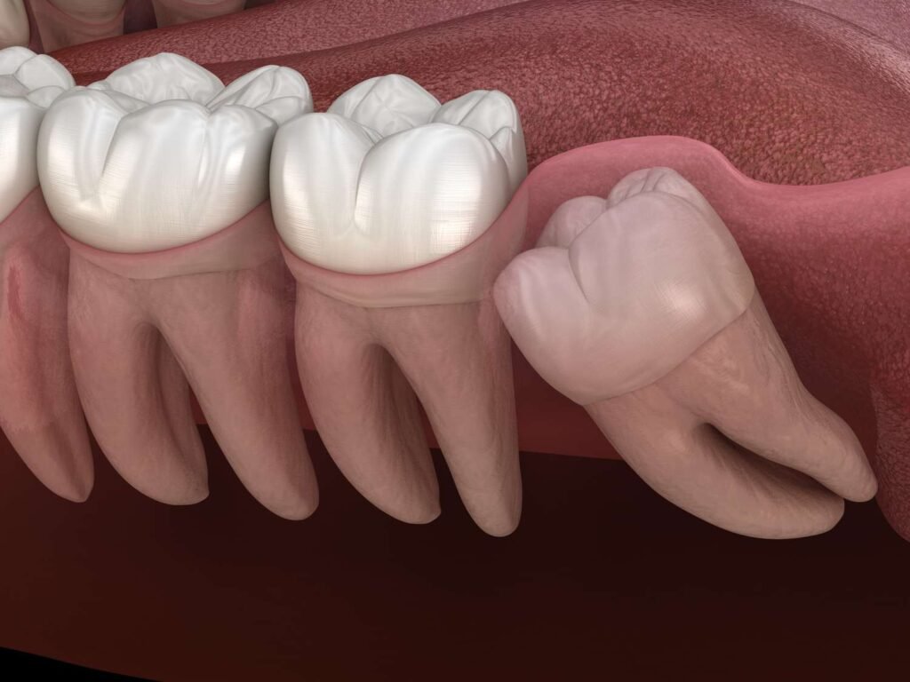 figsdentalwishdhomteeth