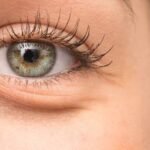 5-under-eye-banner
