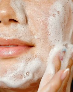 Acne Wash: A Simple Guide to Caring for Acne-Prone Skin