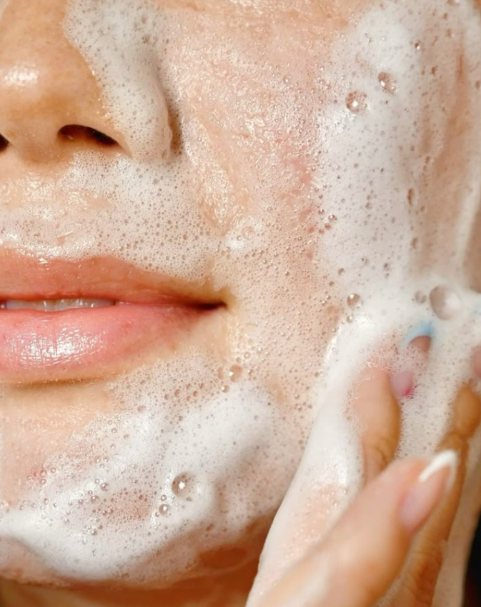 Acne Wash: A Simple Guide to Caring for Acne-Prone Skin