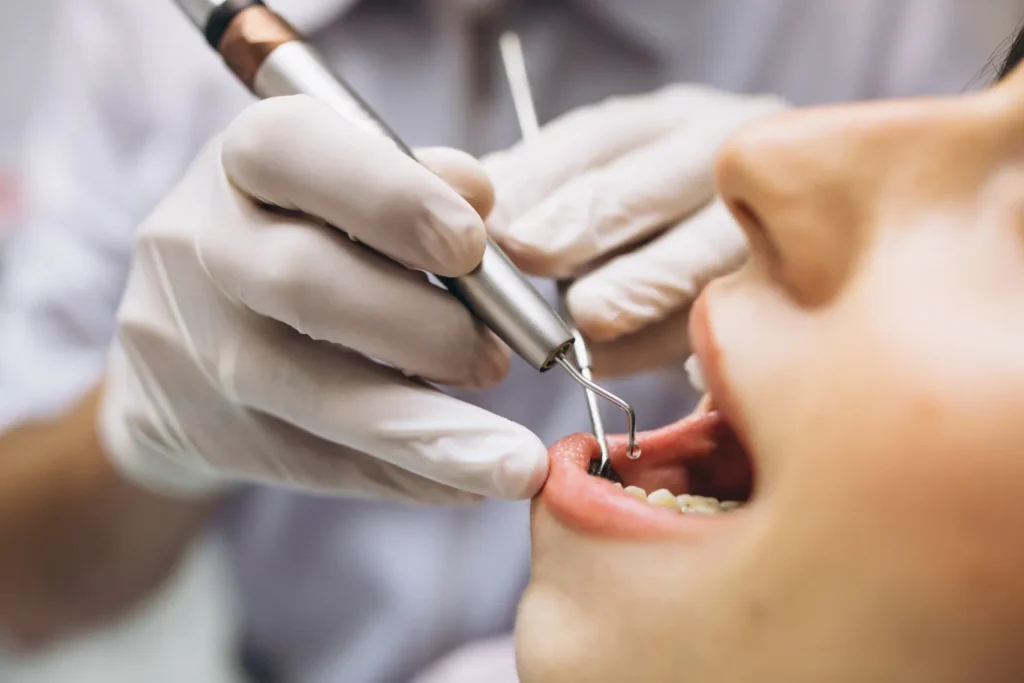 When Is Gum Surgery Recommended