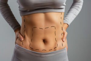 Liposuction Cost in Dubai: Does the Treatment Area Change the Price?