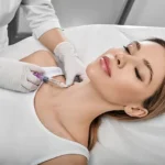 kybella clinic san carlos ca