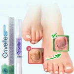 Orivelle fungus treatment