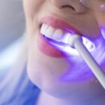 teeth-whitening-services